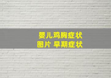 婴儿鸡胸症状图片 早期症状